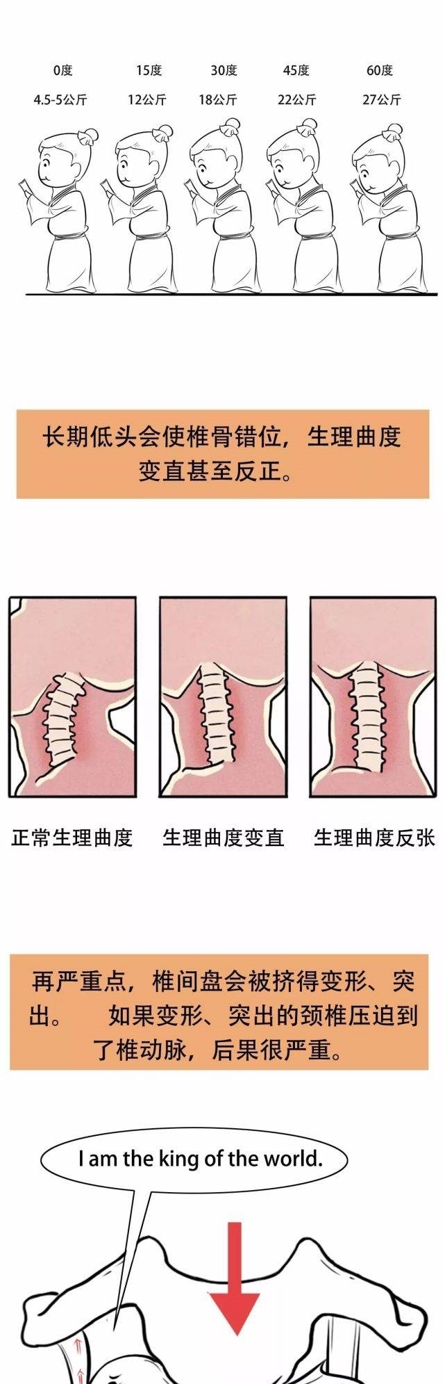 坏掉|【漫画】你的颈椎是怎么坏掉的?附颈椎保健操