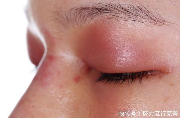  黄曲霉毒素|转告家人这种水果堪称“毁肝王”，早该拉入黑名单，趁早管住嘴