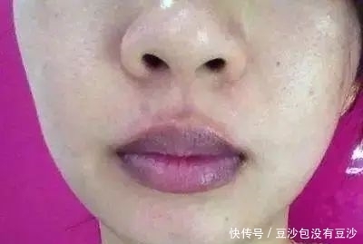 小林|27岁女子,突发猝死,身体出现1肿、2紫、3多,去查查心脏