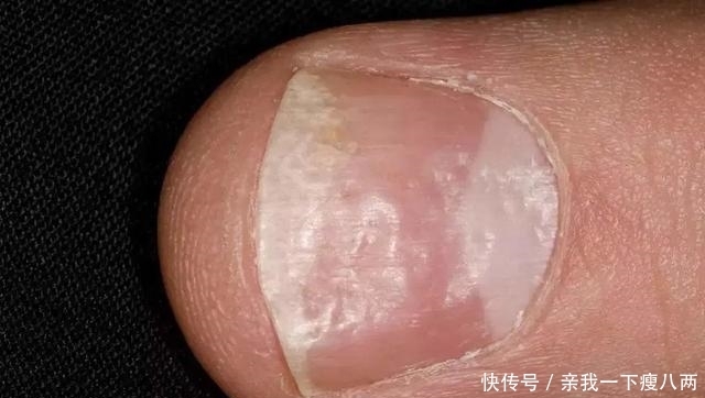  人体内|肝最怕你做8件事，第5件很多人忍不住，第8件最严重