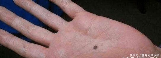自拍照|女子网上发了张手掌上有黑点的自拍照, 朋友看到后却立刻报了警