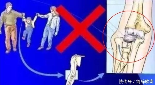 胳膊|父母热衷于牵着宝宝学走路,反而“费力不讨好”,娃受伤都不知道