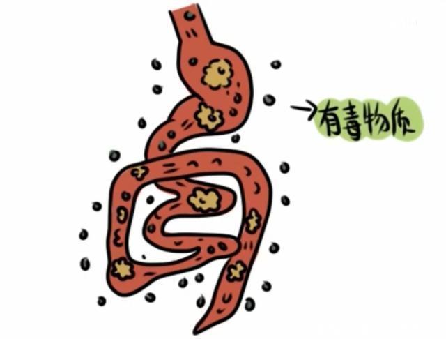 们憋住的屁|你知道人体憋住的屁，最后都去哪里了吗