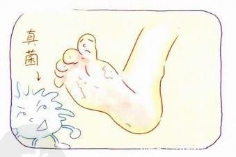  征兆|脚气被传染了怎么办被传染脚气的征兆