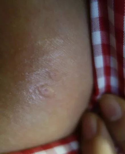  暴雨|头皮发麻！暴雨过后，多处出现小飞虫！