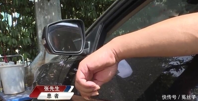  停车|男子停车时把手伸出窗外听到“咔嚓”一声顿时疼痛难忍骨折了