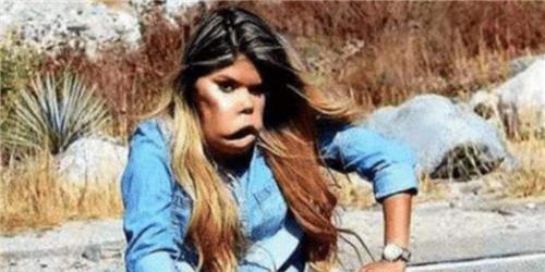 少女|印度少女因长相神似猴头走红,被富豪明媒正娶回家后,现怎样?