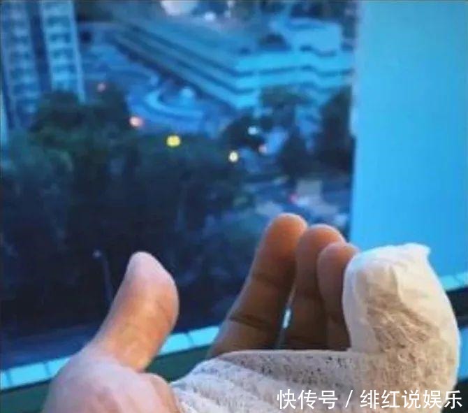  观察|又一位艺人遭狗咬伤！TVB人气小生送院观察等候手术逾18小时