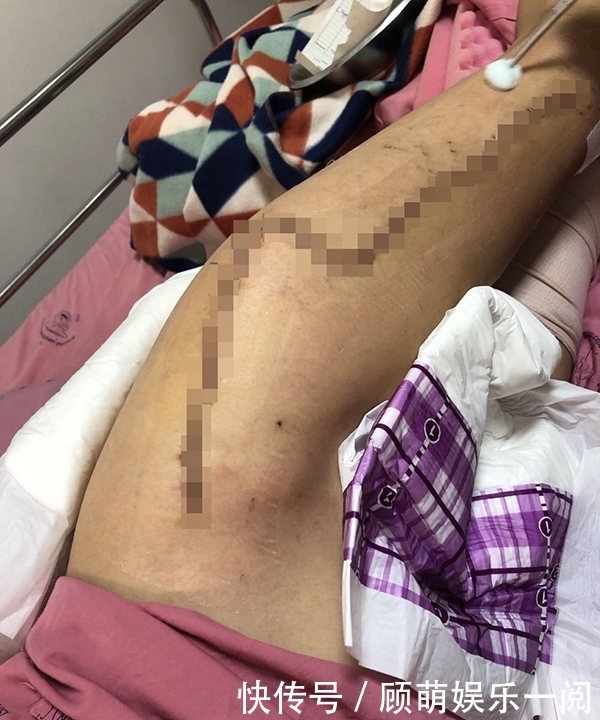 地狱|回访｜泰国坠崖孕妇：从地狱回来的人，不想阴暗地活