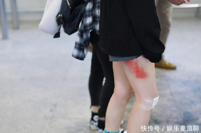 质疑|黄龄摔下舞台,网友质疑这是陷阱吧?