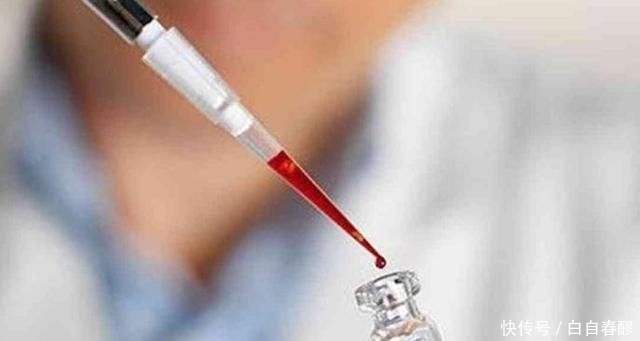  刘先生|中国爸妈生出“混血宝宝”，3次亲子鉴定后，宝爸乐开了花