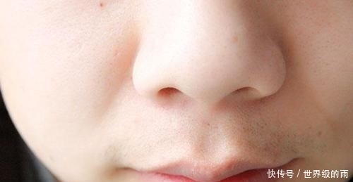 东西|鼻子挤出的 “白色小米粒”是什么东西?别乱挤,当心越挤越多