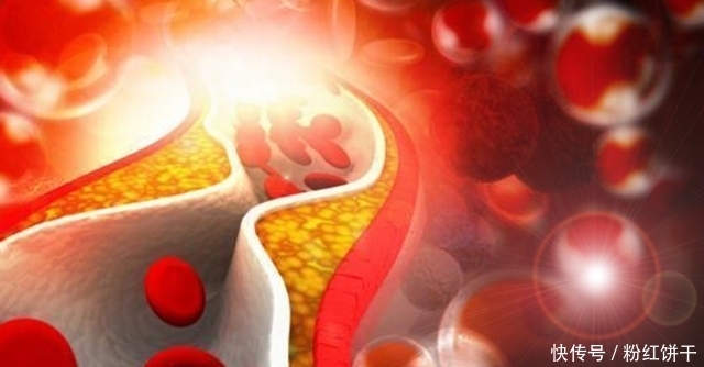 为啥|肝功能检查怎么看？转氨酶升高是为啥？看懂检查，治病不花冤枉钱