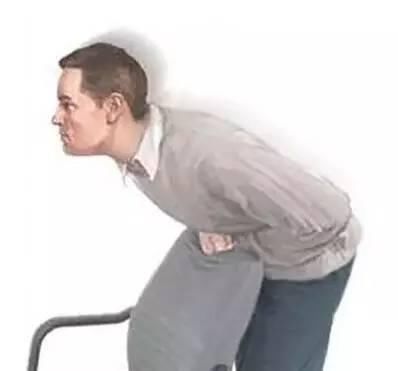 中山医院|男子胸闷气促两个多月，原来是支气管被猪骨头”塞住“了