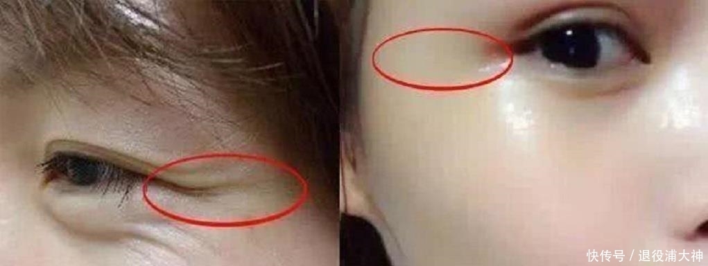 大牌|维生素E加它抹在脸上,坚持7天紧致肌肤淡化色斑,堪比大牌!