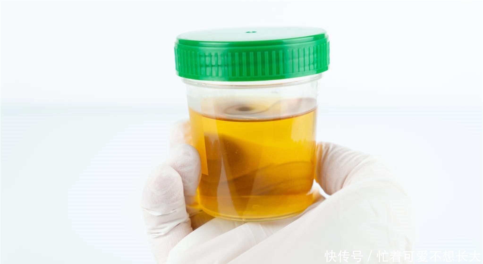 修复|它是天然强肝王，没事多吃，修复肝细胞，肝脏可能会报答你