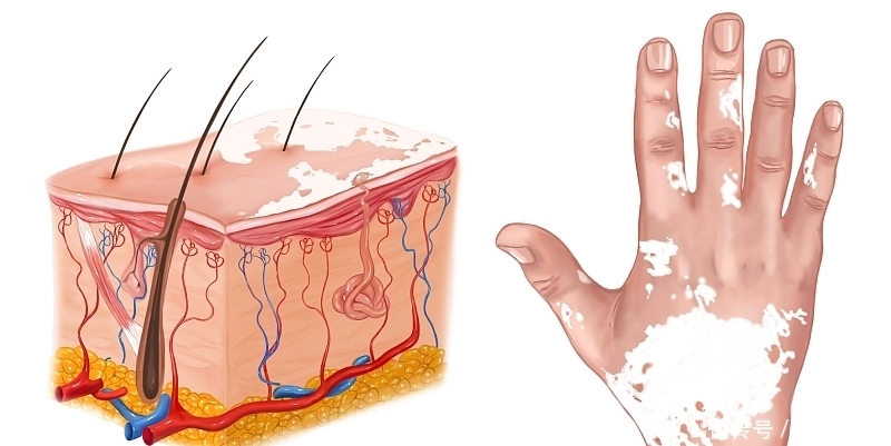  多试试|高血脂的“天敌”被找到，血脂高的人多试试，帮你刮掉血管里的油