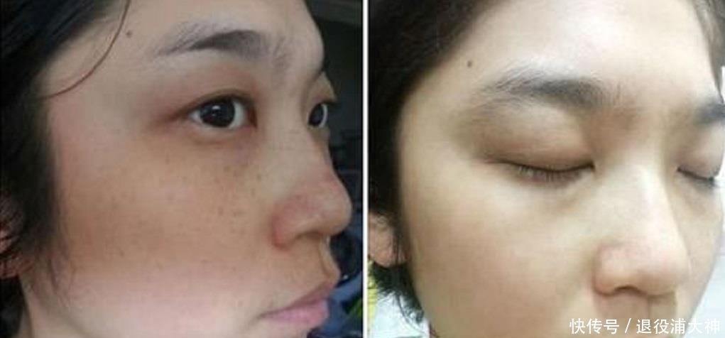 大牌|维生素E加它抹在脸上,坚持7天紧致肌肤淡化色斑,堪比大牌!