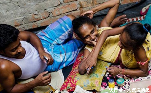 连体人结婚后,到底是如何生活的?看完刷新你的三观